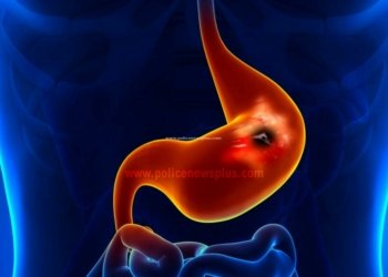 அல்சரை குணப்படுத்தும் ஒரு சில உணவுகள்