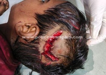 பலத்த காயங்களுடன் சிறுவன் மருத்துவமனையில் அனுமதி