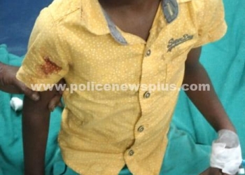 தெரு நாய்களால் பொதுமக்களுக்கு அவதி